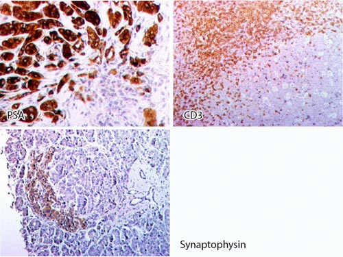 Novodiax Q Stain Poly Hrp Goat Anti Rabbit Igg Ready To Use Novodiax